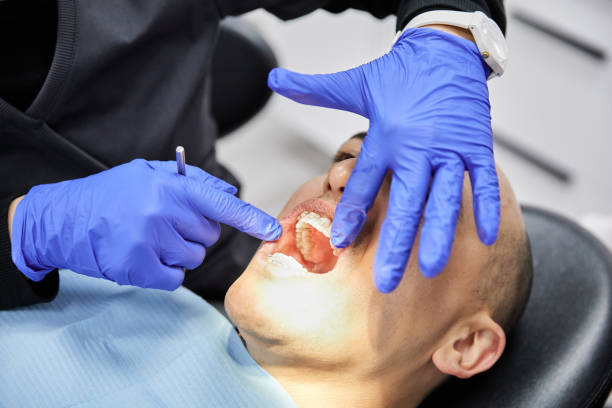Best Emergency Wisdom Tooth Extraction in Durant, OK