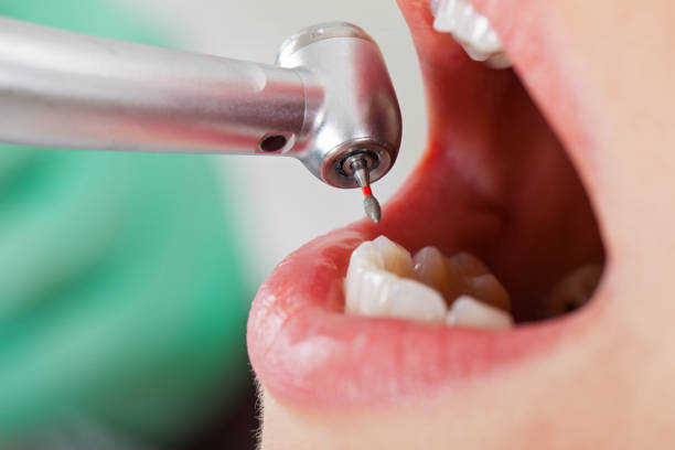 Best Broken or Chipped Tooth Repair in Durant, OK